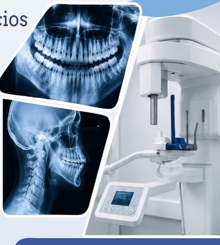 Radiografías y equipo de imágenes maxilofaciales