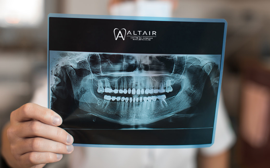Radiografía panorámica dental en Los Olivos